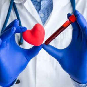 C-Reactive Protein (High Sensitivity)