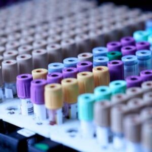 Complete Blood Count (CBC)