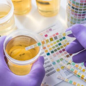 Urinalysis